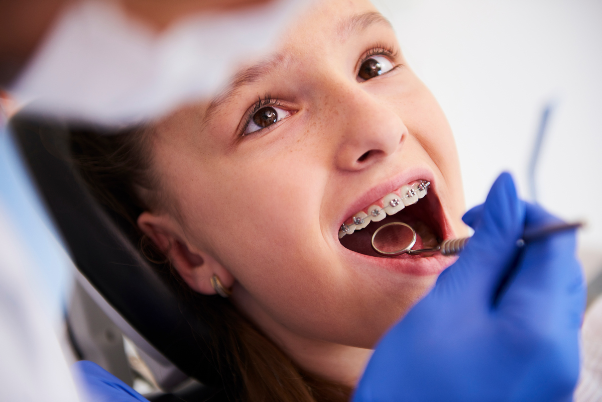 Importanța Aparatelor Dentare la Copii