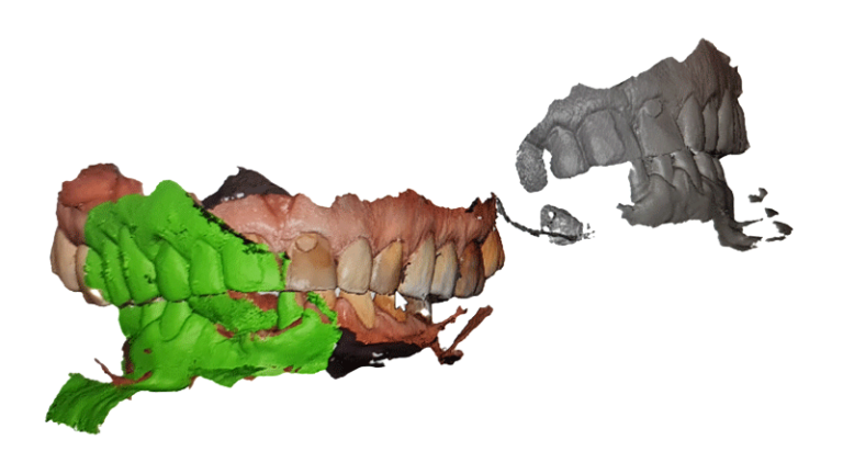 Model dentar digital